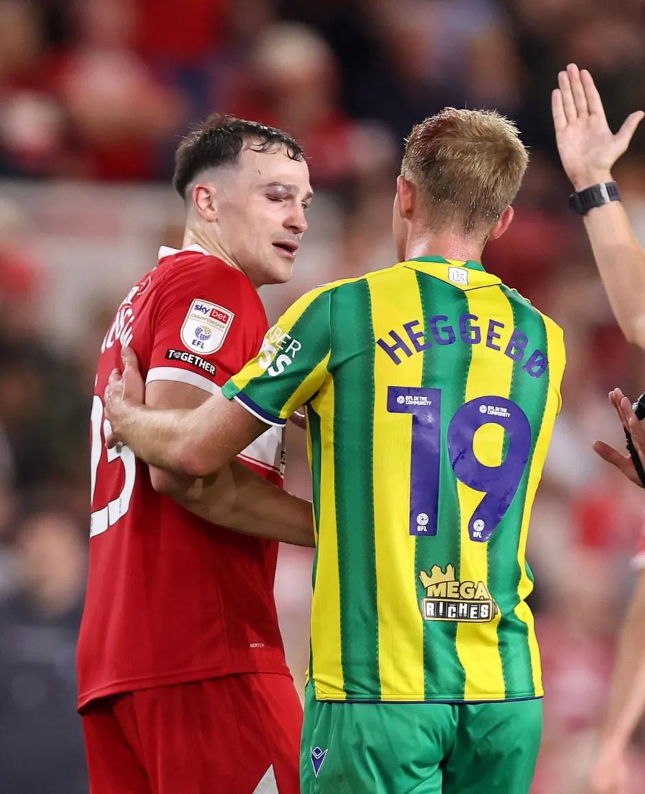 眼睛肿得也 眼睛肿得也